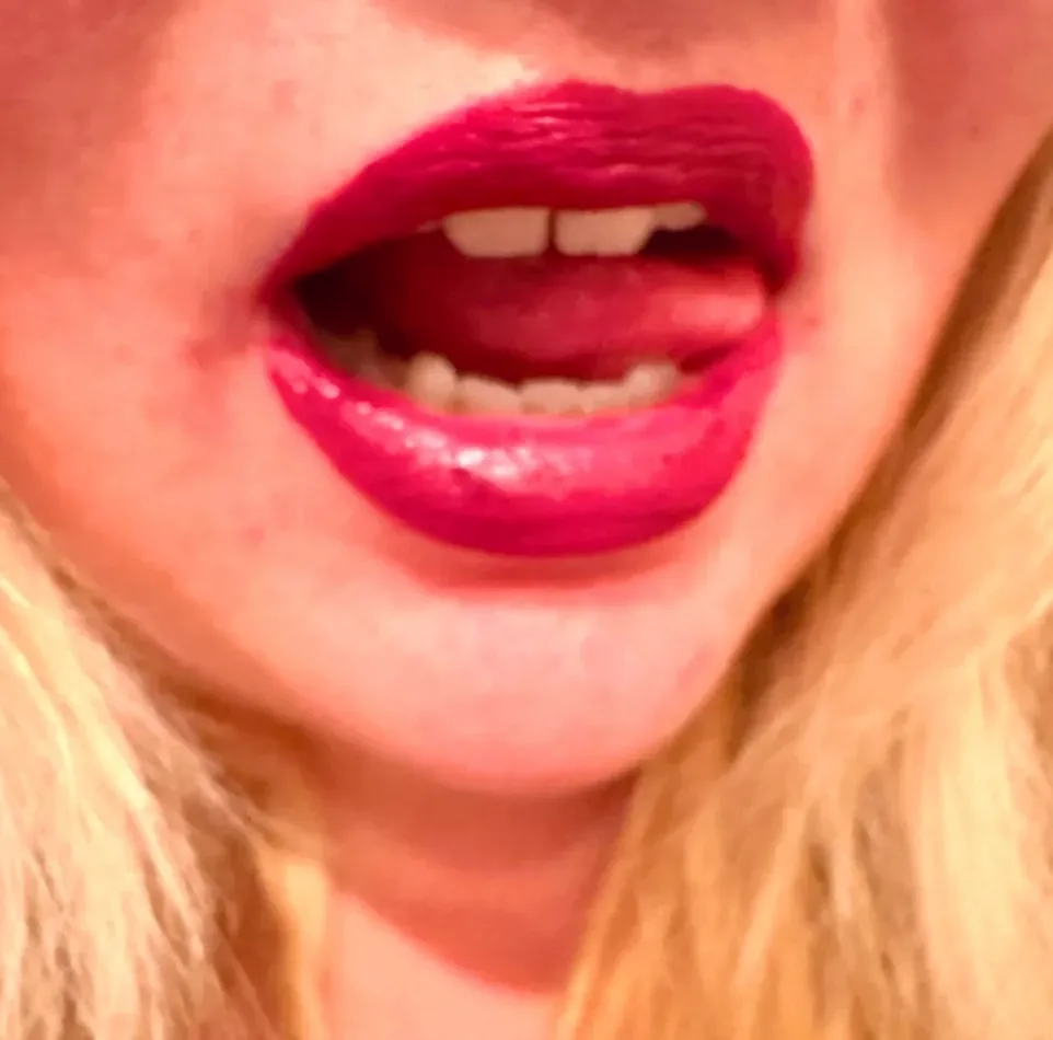 Noa, 24